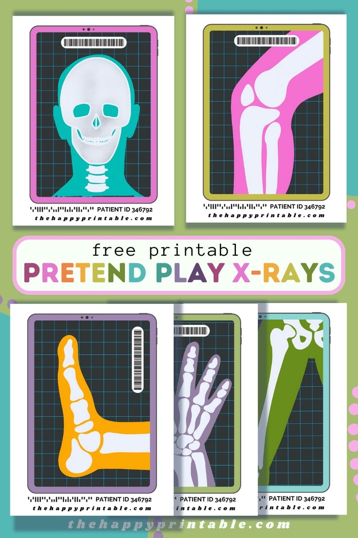 Printable Pretend X Rays